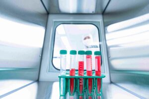 Quy trình xử lý và lưu trữ tế bào gốc trong phòng lab