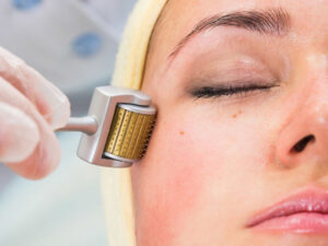 Tế bào gốc kết hợp PRP: tái tạo da hiệu quả